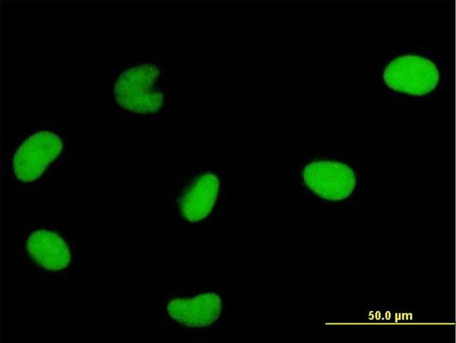 DUT Antibody in Immunocytochemistry (ICC/IF)