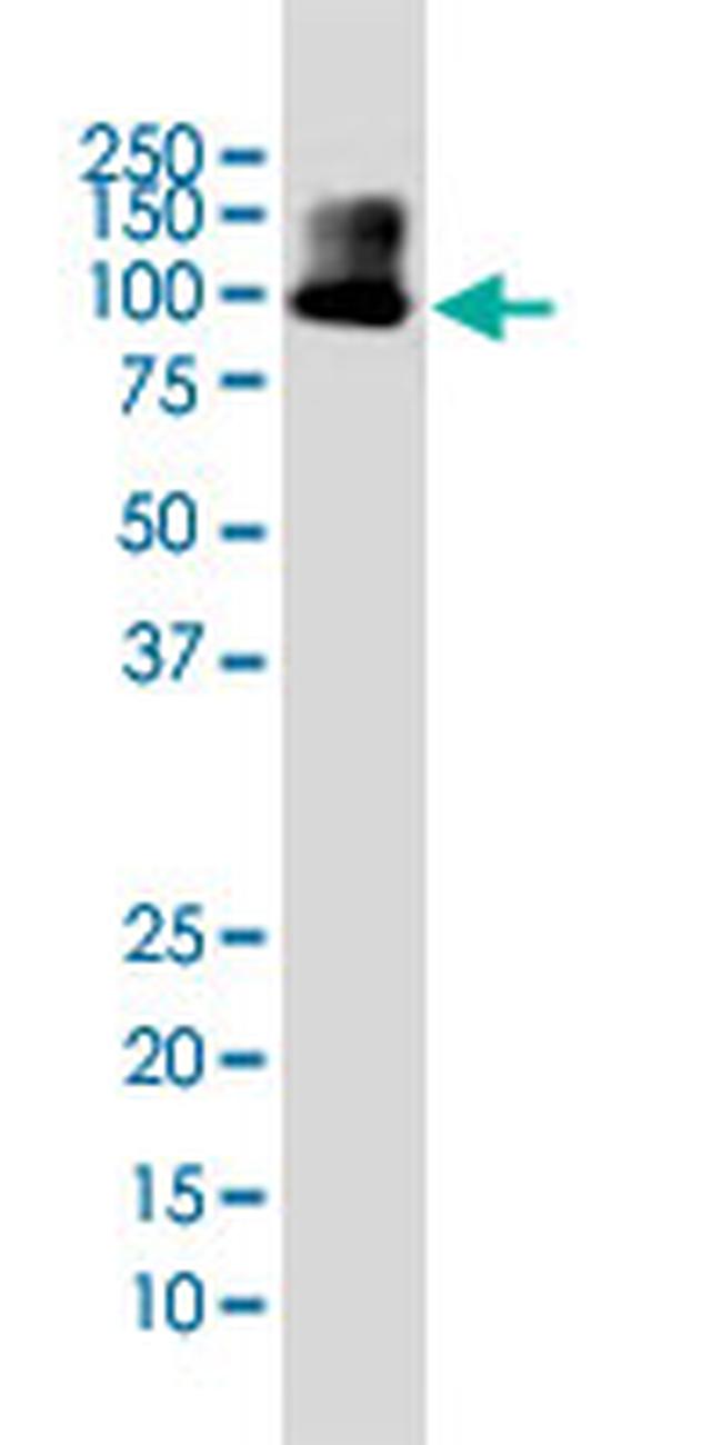 DYRK1A Antibody in Western Blot (WB)