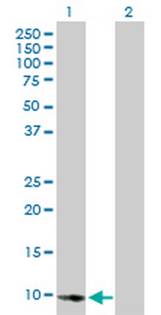 E2F2 Antibody in Western Blot (WB)