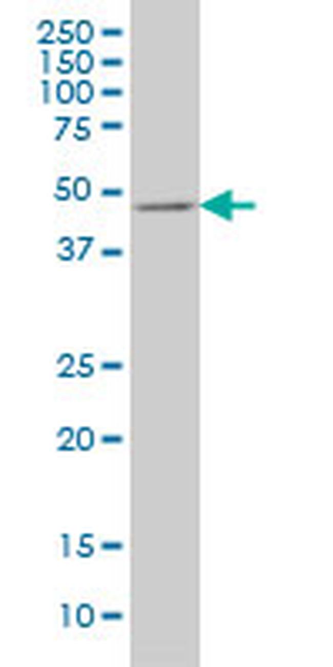 E2F3 Antibody in Western Blot (WB)