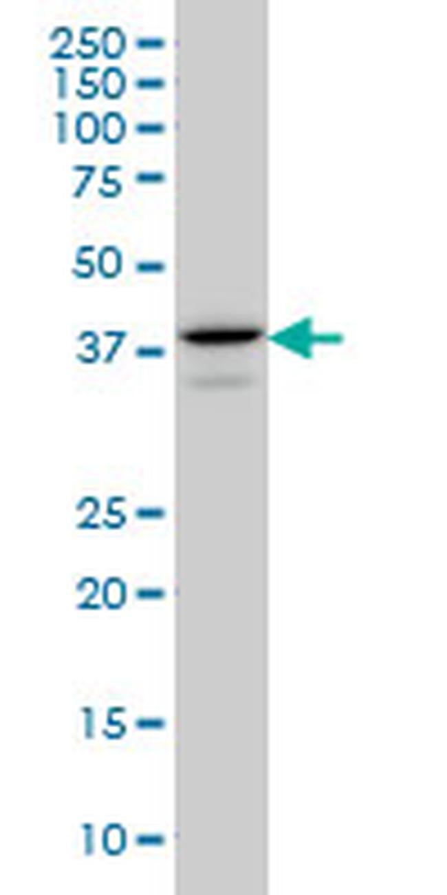 E2F4 Antibody in Western Blot (WB)