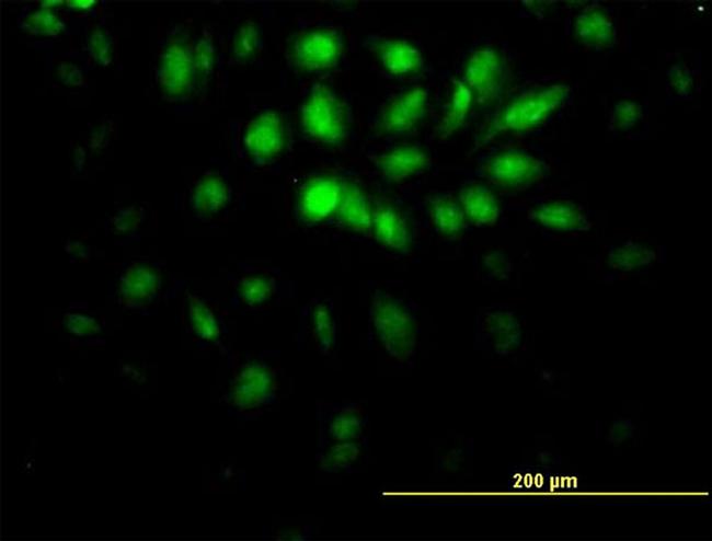 E2F6 Antibody in Immunocytochemistry (ICC/IF)