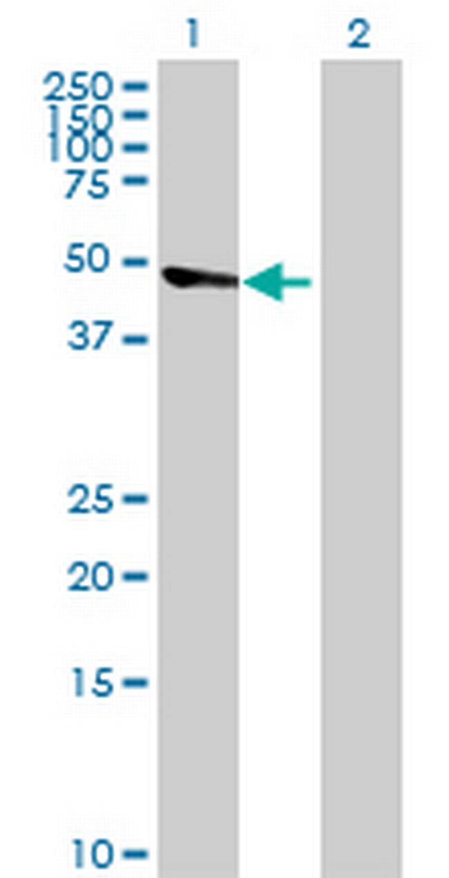 ECGF1 Antibody in Western Blot (WB)