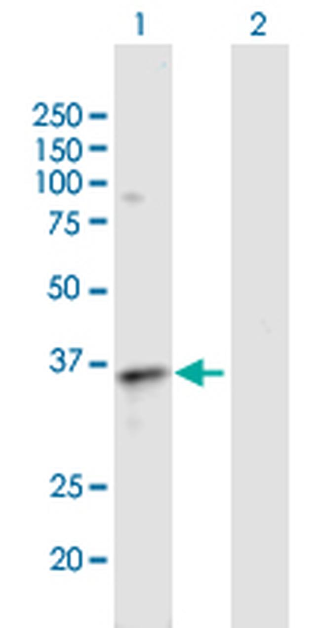 EDG3 Antibody in Western Blot (WB)