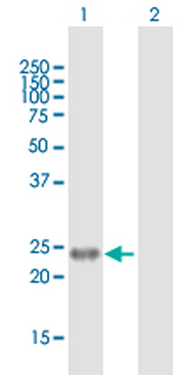 EDN1 Antibody in Western Blot (WB)