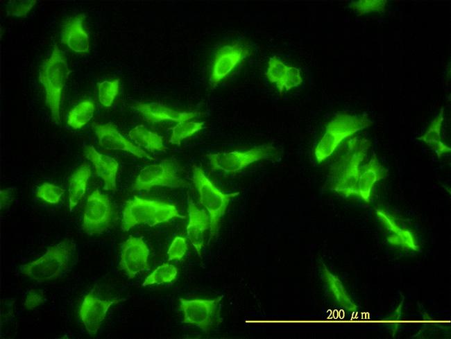 EEF1G Antibody in Immunocytochemistry (ICC/IF)