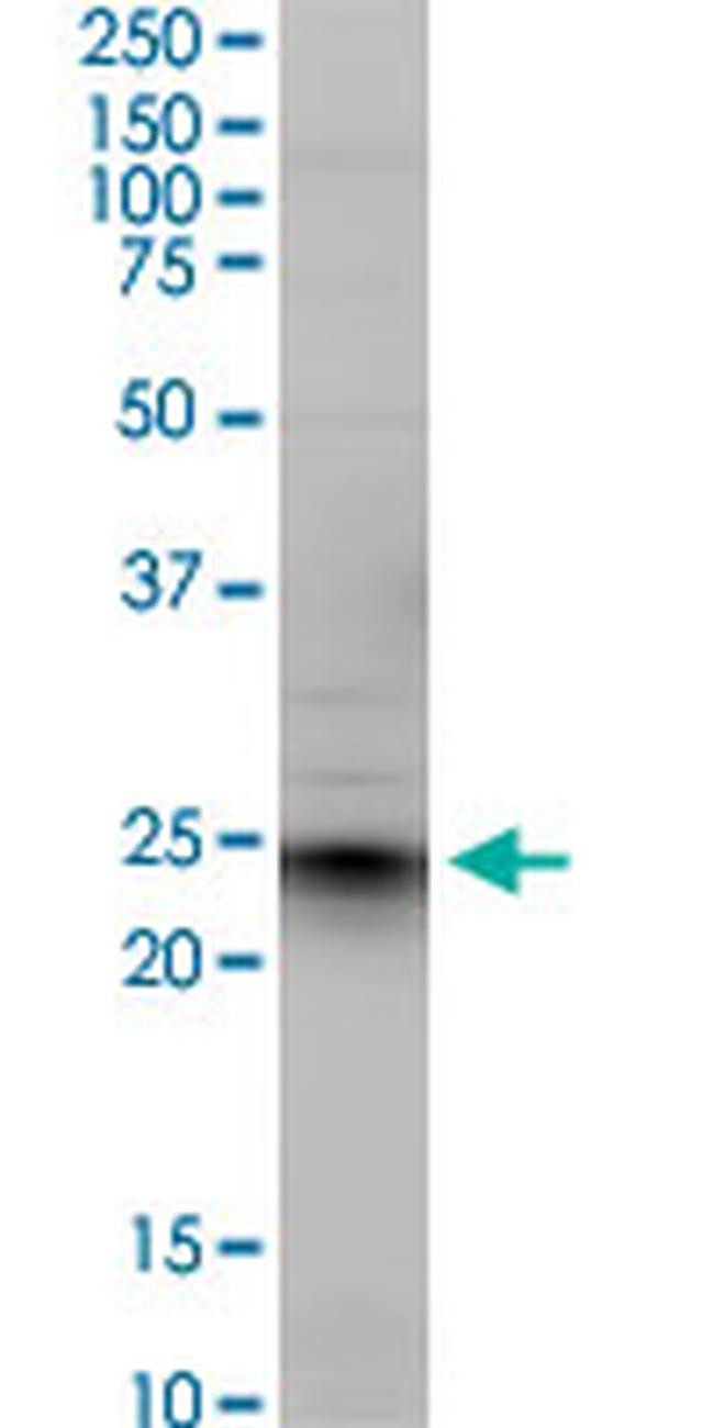 EFNA5 Antibody in Western Blot (WB)