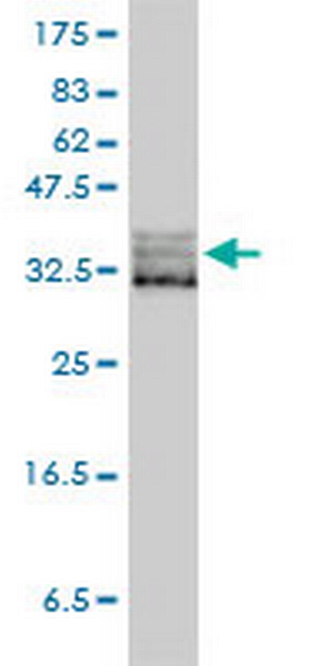 EIF2S1 Antibody in Western Blot (WB)