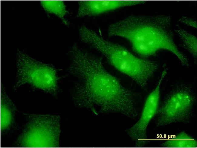 EIF2S3 Antibody in Immunocytochemistry (ICC/IF)