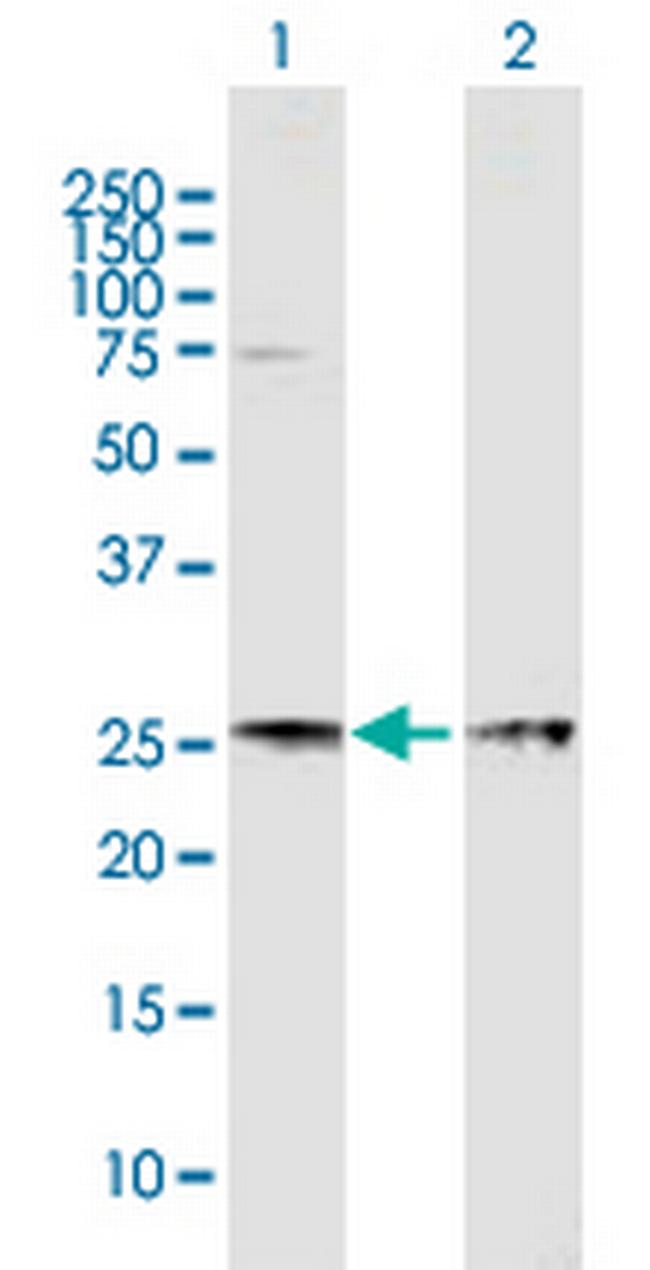 EIF4E Antibody in Western Blot (WB)