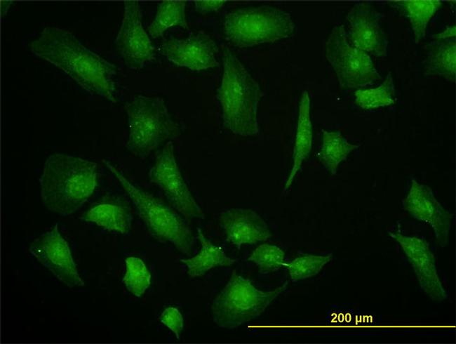 EIF4G1 Antibody in Immunocytochemistry (ICC/IF)