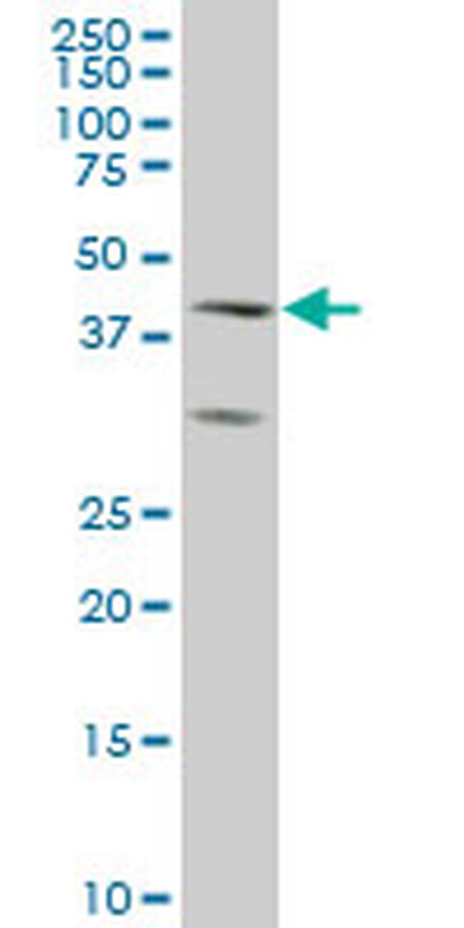 ELF3 Antibody in Western Blot (WB)