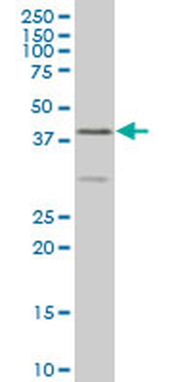 ELF3 Antibody in Western Blot (WB)