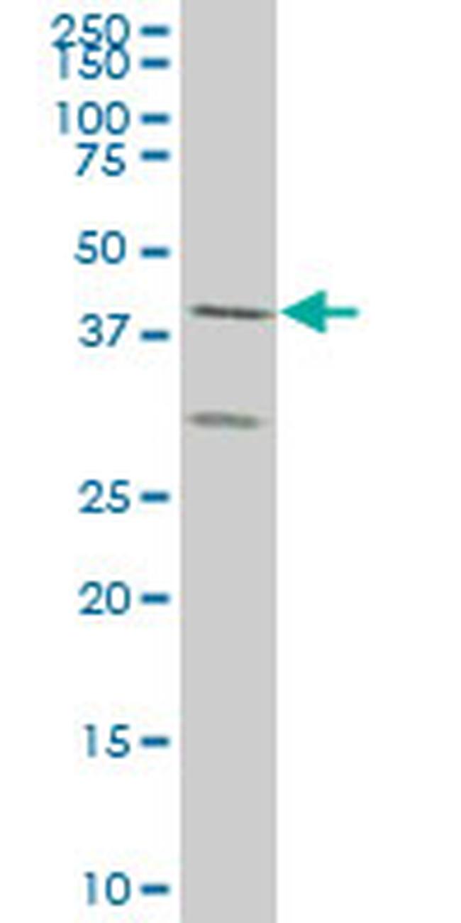 ELF3 Antibody in Western Blot (WB)