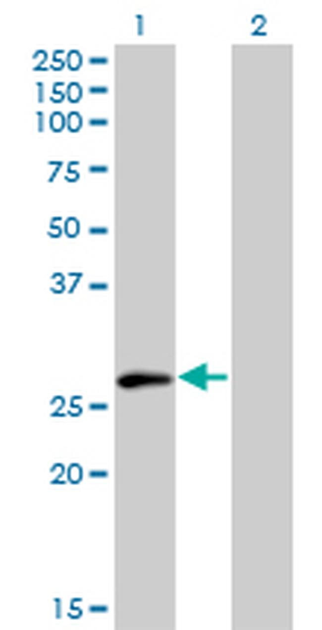 ELF5 Antibody in Western Blot (WB)