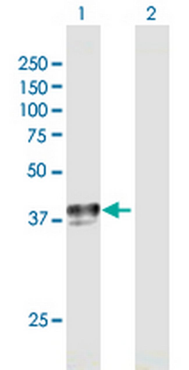 SLC29A1 Antibody in Western Blot (WB)