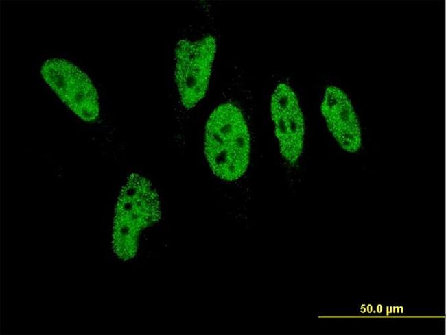 EP300 Antibody in Immunocytochemistry (ICC/IF)