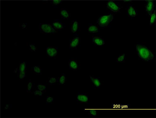 EP300 Antibody in Immunocytochemistry (ICC/IF)