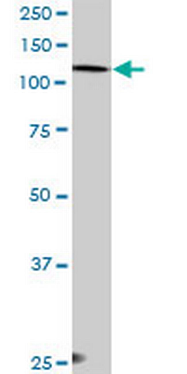 EPB41L2 Antibody in Western Blot (WB)