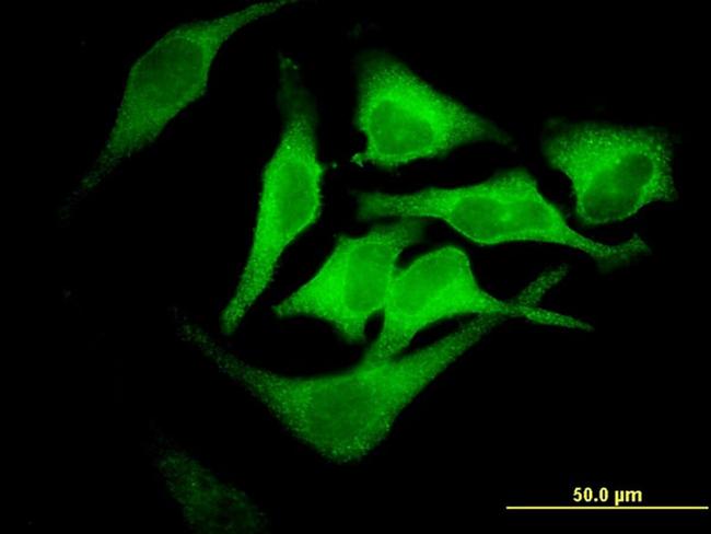 EPB42 Antibody in Immunocytochemistry (ICC/IF)