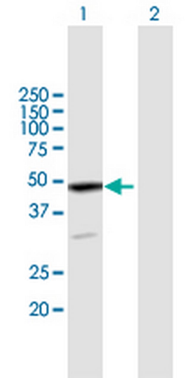 EPB49 Antibody in Western Blot (WB)