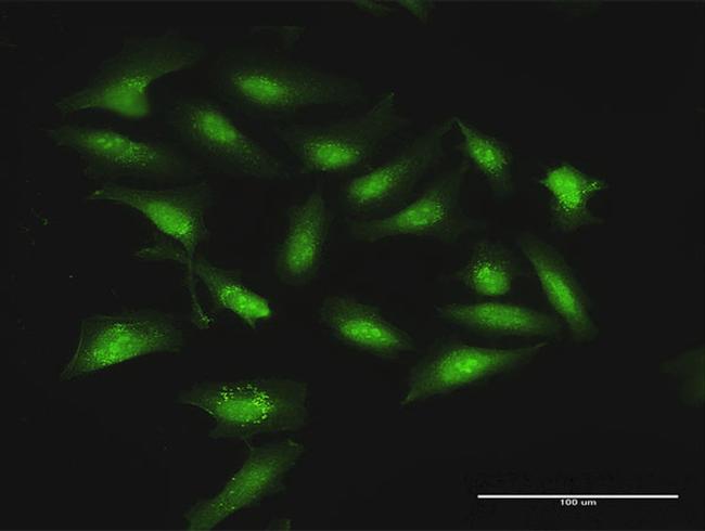 STOM Antibody in Immunocytochemistry (ICC/IF)