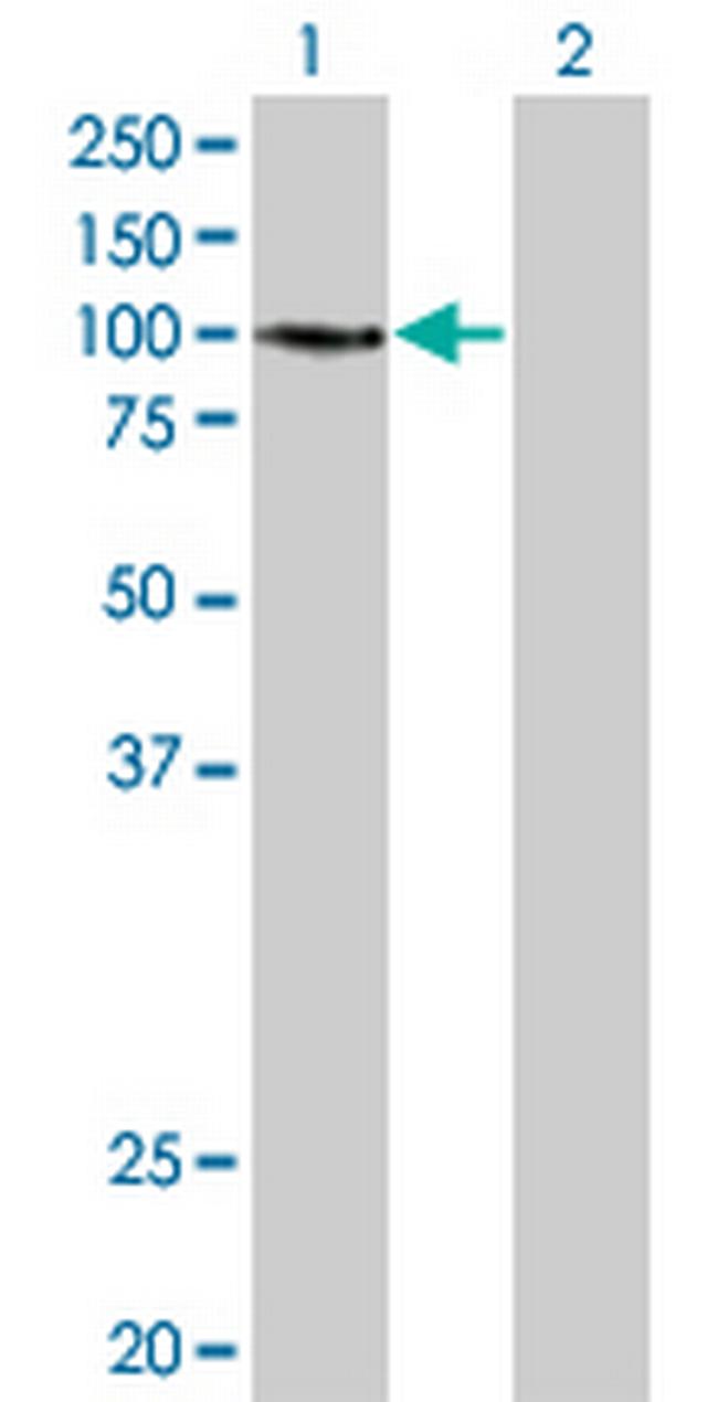 EPHA3 Antibody in Western Blot (WB)