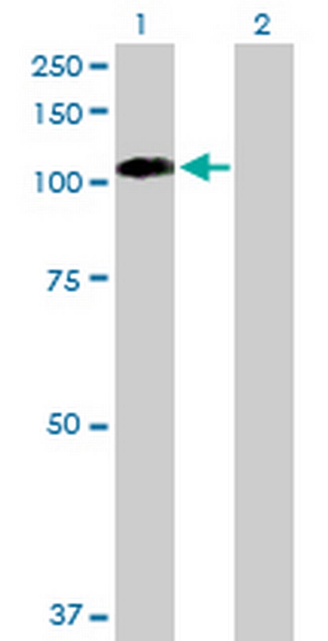 EPHB1 Antibody in Western Blot (WB)