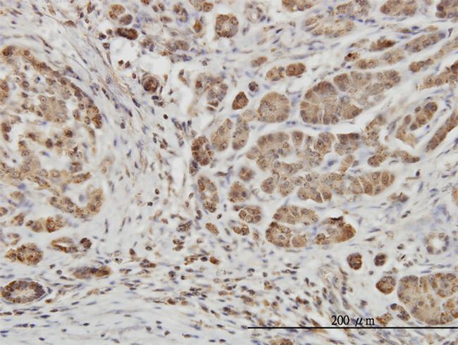 EPHB6 Antibody in Immunohistochemistry (Paraffin) (IHC (P))