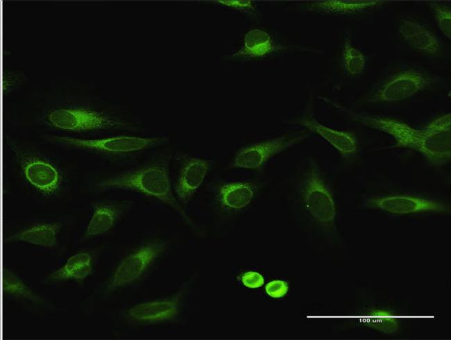 EPHX1 Antibody in Immunocytochemistry (ICC/IF)