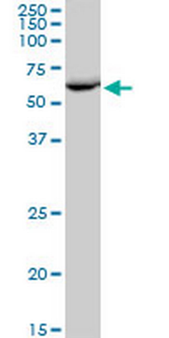 EPHX2 Antibody in Western Blot (WB)