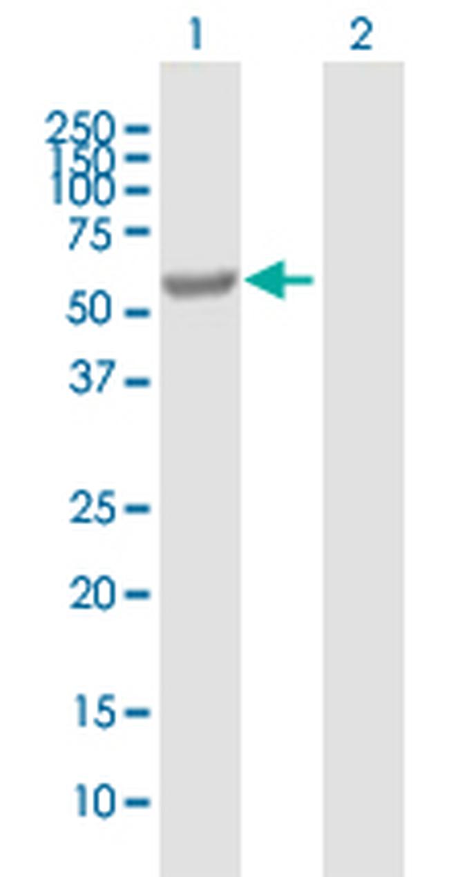 EPHX2 Antibody in Western Blot (WB)