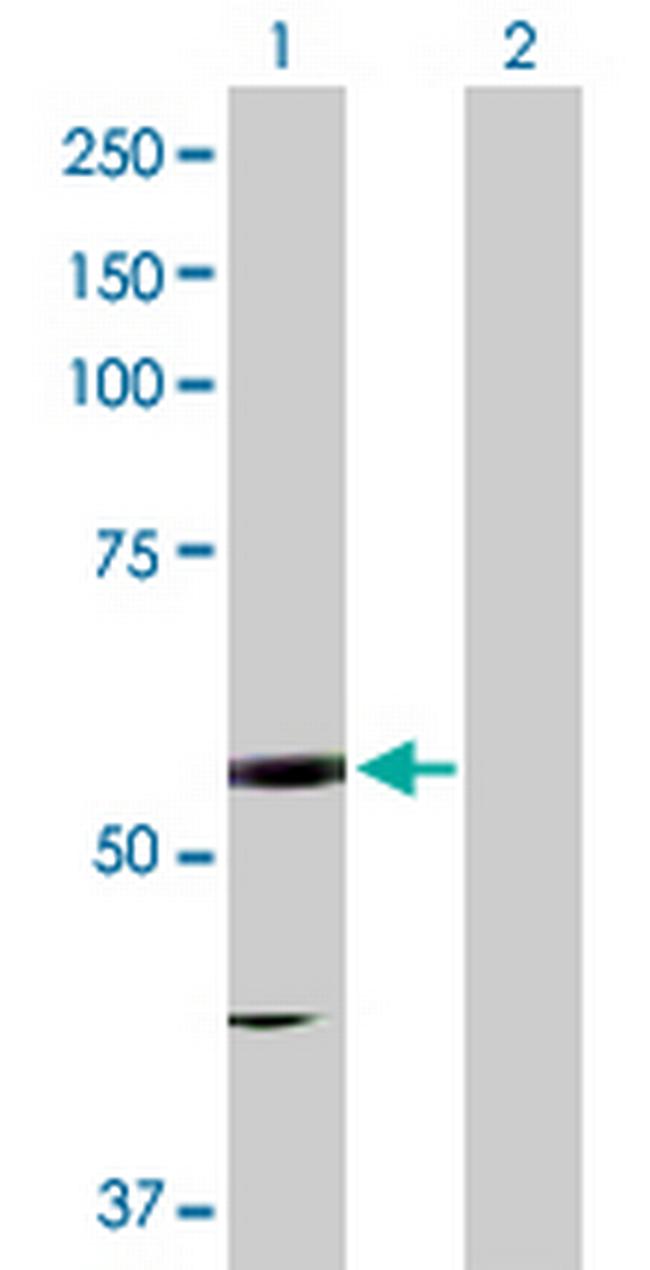 EPHX2 Antibody in Western Blot (WB)