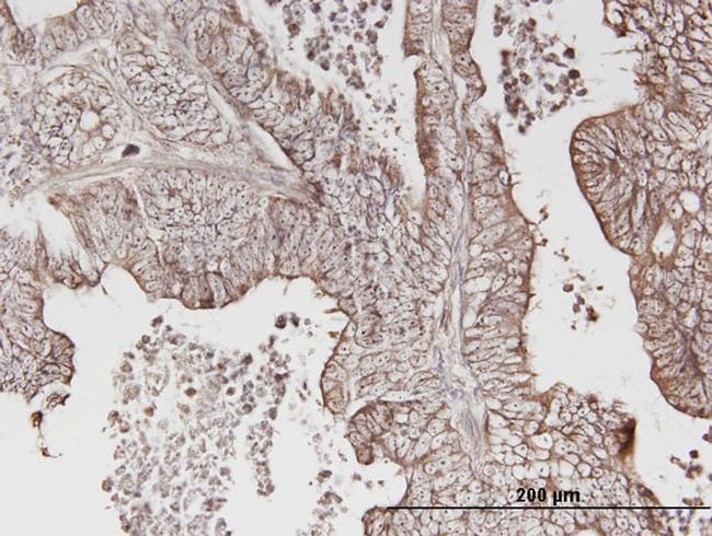 ERBB3 Antibody in Immunohistochemistry (Paraffin) (IHC (P))