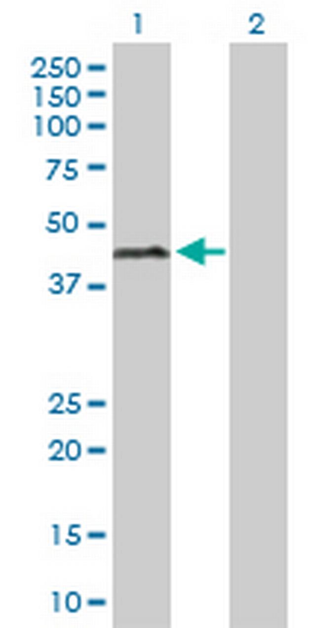 ERCC1 Antibody in Western Blot (WB)