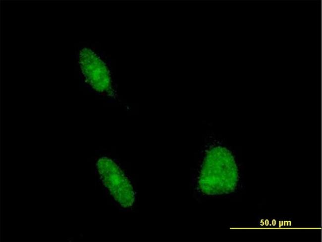 ERCC1 Antibody in Immunocytochemistry (ICC/IF)