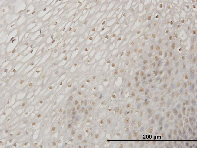 ERN1 Antibody in Immunohistochemistry (Paraffin) (IHC (P))