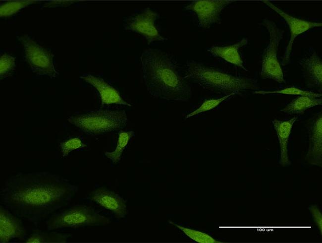 ESR1 Antibody in Immunocytochemistry (ICC/IF)