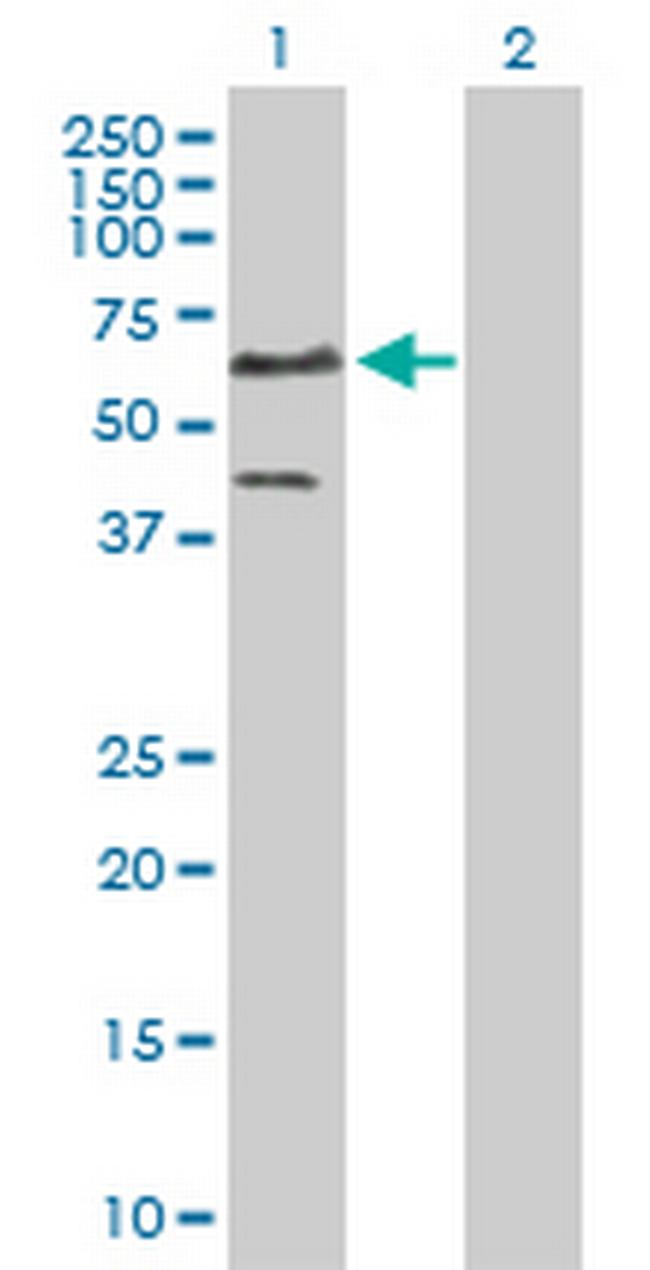 ETS1 Antibody in Western Blot (WB)