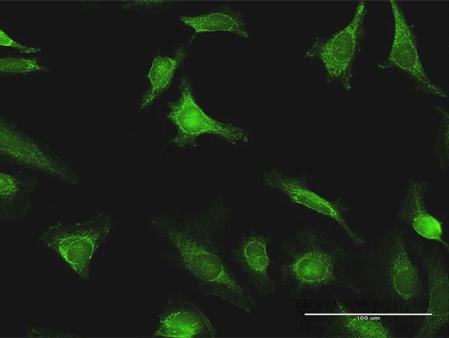 EXT1 Antibody in Immunocytochemistry (ICC/IF)