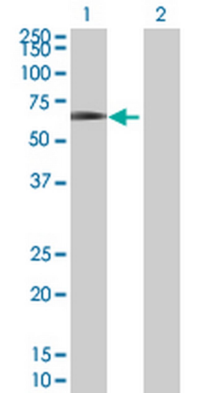 EYA2 Antibody in Western Blot (WB)