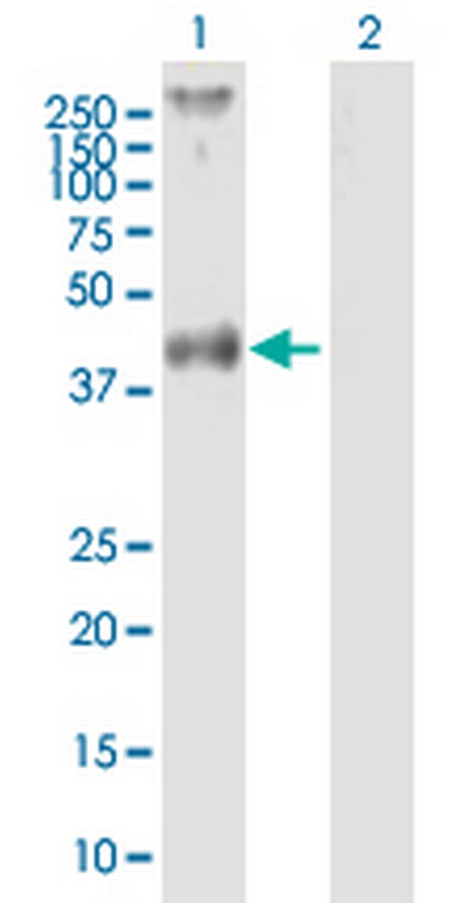 F2R Antibody in Western Blot (WB)