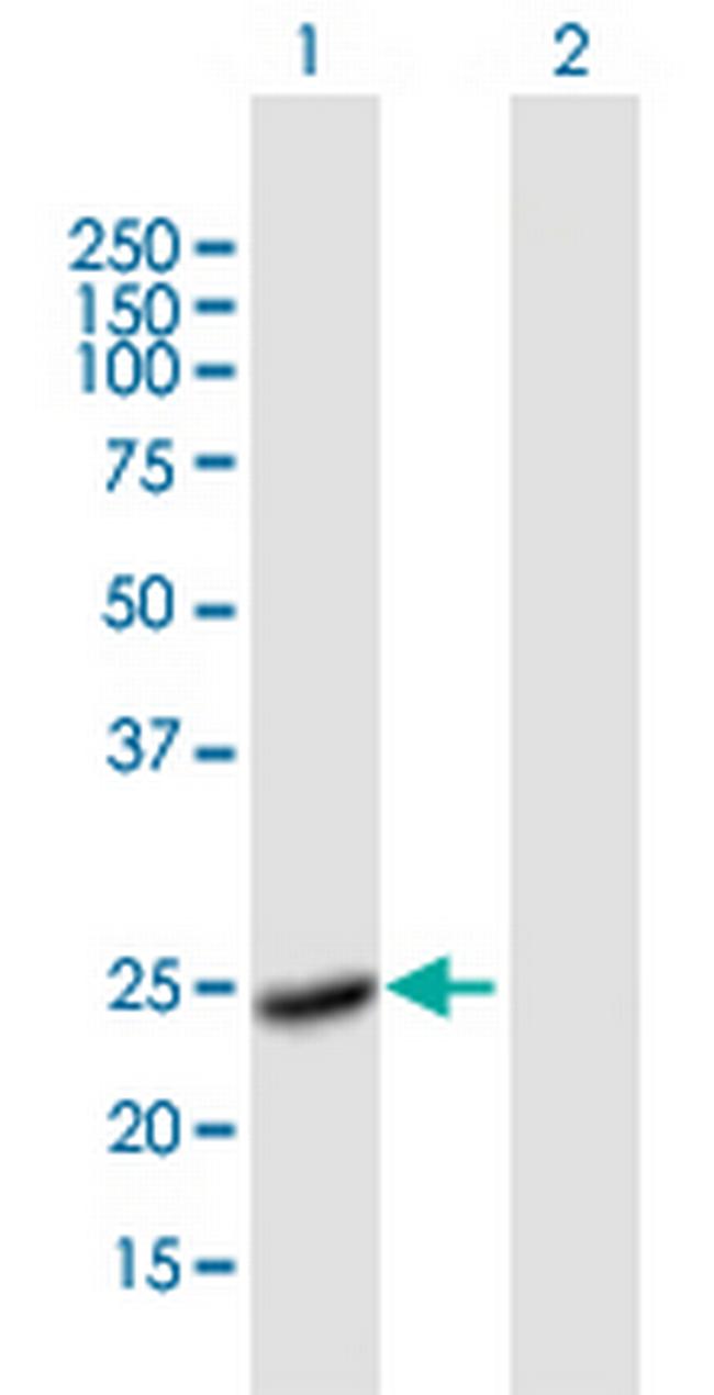 F8 Antibody in Western Blot (WB)