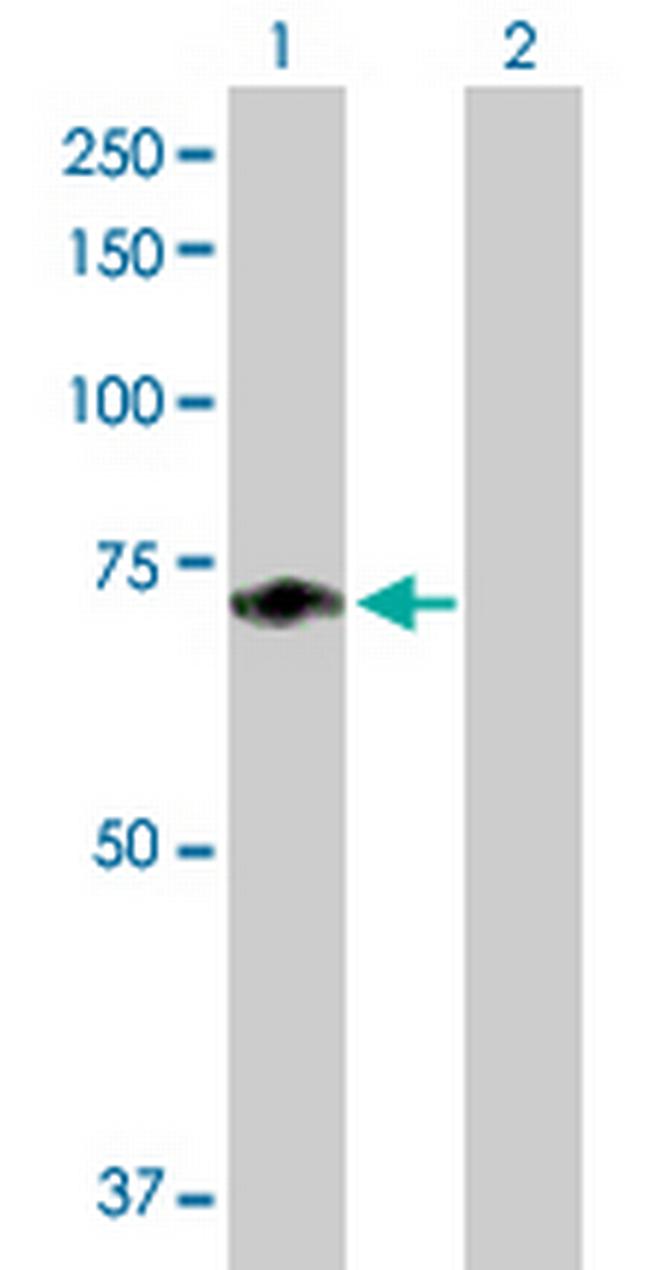 F11 Antibody in Western Blot (WB)