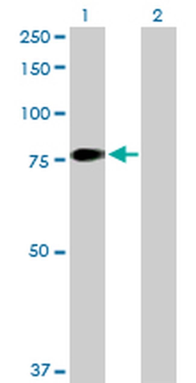 F11 Antibody in Western Blot (WB)