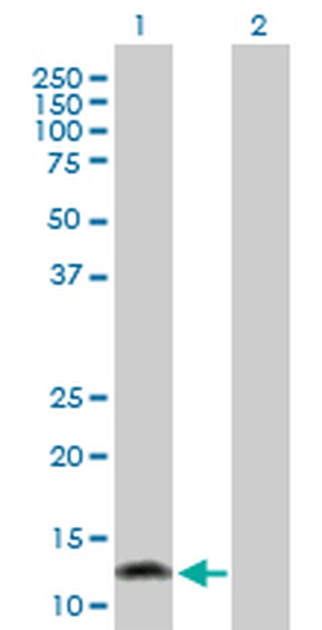 FABP1 Antibody in Western Blot (WB)