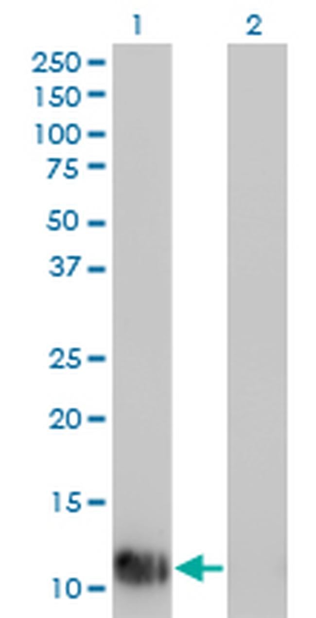 FABP1 Antibody in Western Blot (WB)