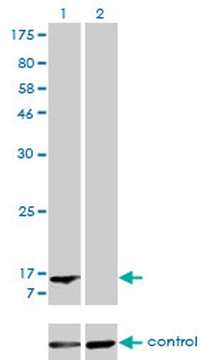 FABP1 Antibody in Western Blot (WB)