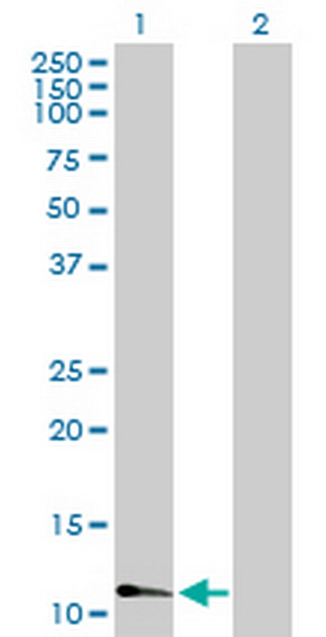 FABP3 Antibody in Western Blot (WB)