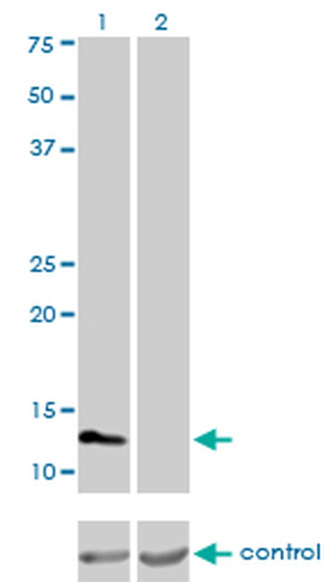 FABP3 Antibody in Western Blot (WB)